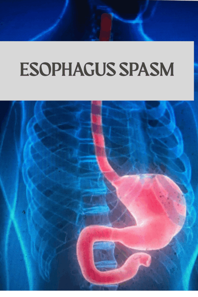 esophagus spasm guide