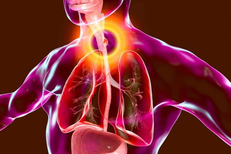 7 BRAVE TRUTHS ABOUT ESOPHAGEAL MOTILITY DISORDER 7 BRAVE TRUTHS ABOUT ESOPHAGEAL MOTILITY DISORDER