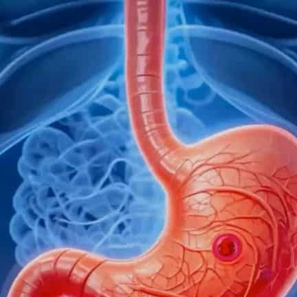 esophageal varices esophageal varices symptoms