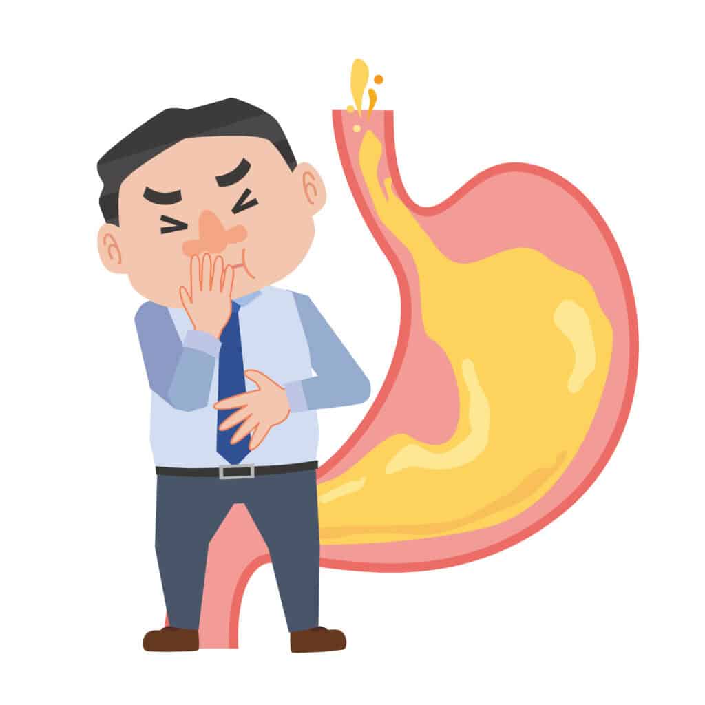 reflux symptoms