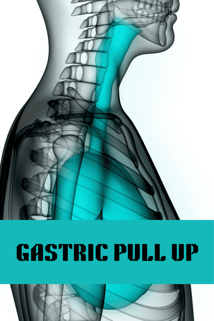gastric pull up 