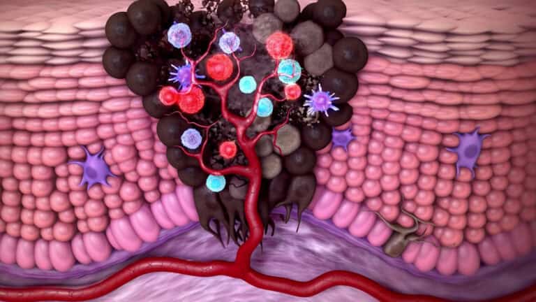 9️⃣ BRAVE METASTATIC ESOPHAGEAL CANCER: WHAT YOU NEED TO KNOW NOW