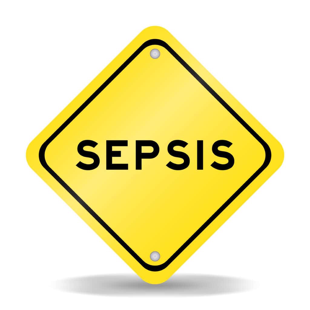 septic inflamed lungs with esophagus cancer sepsis lung cancer